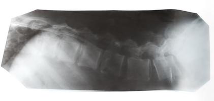 röntgenbild der menschlichen wirbelsäule isoliert foto