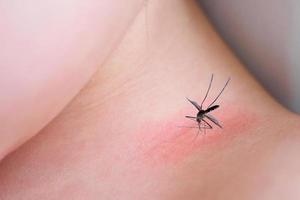 Hautausschlag und Allergie des kleinen asiatischen Mädchens mit rotem Fleck, verursacht durch Mückenstich foto