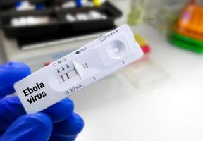 Schnelltestkassette für den Ebola-Virus-Test. foto
