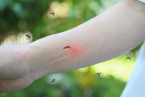 Mückenstich am Arm eines Erwachsenen mit Hautausschlag und Allergie mit rotem Fleck foto