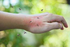 Mücken beißen auf erwachsenen handgemachten Hautausschlag und Allergie mit rotem Fleck foto