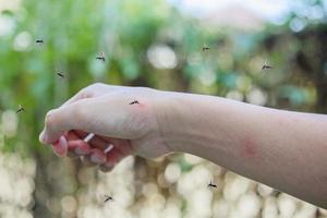 Mücken beißen auf erwachsenen handgemachten Hautausschlag und Allergie mit rotem Fleck foto