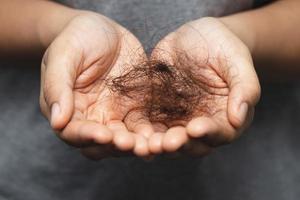 Frauen haben Probleme mit Haarausfall. foto