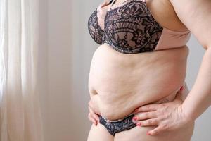 Fette Frau, übergewichtige Frau hält übermäßiges Bauchfett in ihren Händen. Konzept reduzieren foto