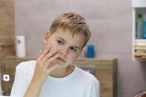 teenager irritiert durch trockene ungesunde haut, besorgt über probleme mit seinem gesicht. foto