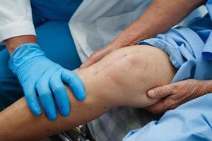Arzt untersucht asiatische ältere Patientin mit Narben-Knieersatzoperation im Krankenhaus. foto