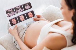 Röntgenbild untersuchen. Draufsicht einer schwangeren Frau, die auf dem Sofa sitzt und ein Röntgenbild ihres Babys hält foto