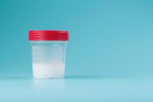 ein Behälter für Biomaterialien mit Spermienanalyse und rotem Deckel auf blauem Hintergrund. foto