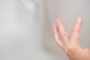 nahaufnahme der finger weibliche hand mit trockener, rissiger haut an der nagelhaut, die haut ist zerrissen und blättert ab und sollte mit der feuchtigkeitscreme zur reparatur behandelt werden. foto