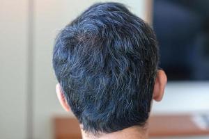 asiatischer mann mit grauem und weißem haar, das aufwächst. Haarproblemkonzept foto