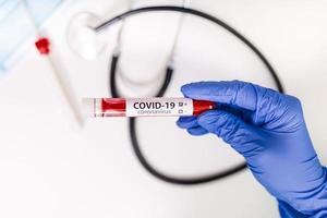 Coronavirus 2019-ncov Blutprobe. neue Epidemie Corona-Virus. ausbruch des corona-virus. Corona-Virus im Labor. wissenschaftler halten röhrchen mit bluttest mit dem virusnamen coronavirus. Impfung foto