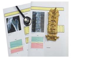 Knochendichte Hüfte und Lendenwirbelsäule führen zu Osteoporose foto