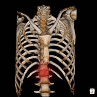 ct-scan 3d rendern menschliches skelettsystem brustskelett anatomie. foto