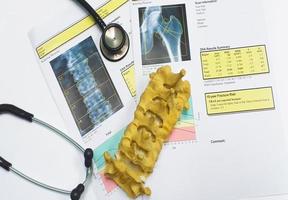 Knochendichte Hüfte und Lendenwirbelsäule führen zu Osteoporose foto