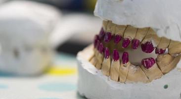 Zahnersatz, Zahnersatz, prothetische Arbeiten. Prothetikhände bei der Arbeit an der Prothese, falsche Zähne, ein Arbeitszimmer und ein Tisch mit zahnärztlichen Werkzeugen foto