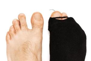 Nahaufnahme von männlichen Füßen mit einem Zeh, der aus einer Hoaly-Socke herausragt. foto