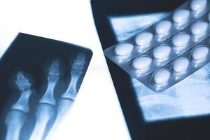 Röntgenbild und Blisterpackung mit weißen Tabletten foto