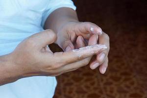 Nahaufnahmehand, die medizinische Creme auf infektiöse Finger aufträgt. konzept, dermatitisbehandlung. Finger mit Pilzen, Bakterien oder Entzündungen. Gesundheits- und Gesundheitsprobleme. foto