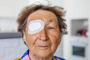Nahaufnahme des verletzten Auges einer älteren Frau foto