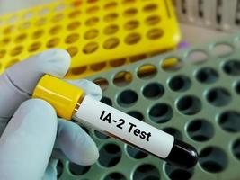 Blutprobe für Insel-Antigen-2 oder ia 2-Test, Pankreas-Insel-Antikörper und ein wichtiger serologischer Marker für die Prädisposition für Typ-1-Diabetes. foto