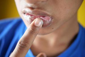 junger Mann, der Vaseline auf die Lippe aufträgt foto