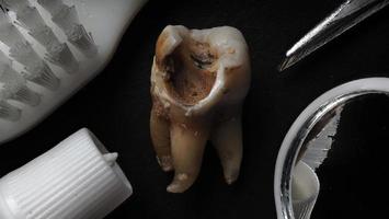 Makroaufnahme eines verfallenen Zahns bis zur Wurzel nach der Extraktion des Zahnarztes. foto