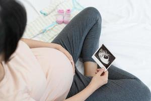 Eine schwangere Frau betrachtet ein Ultraschallfoto des Fötus. Mutter berührt das Baby sanft auf dem Bauch. Frauen sind 2-3 Tage oder während des ersten Trimesters schwanger. foto