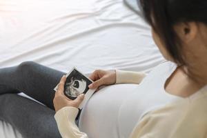 Eine schwangere Frau betrachtet ein Ultraschallfoto des Fötus. mutter berührt das baby sanft auf dem bauch. frauen sind 30 wochen schwanger. erste Liebe im Bauch und letzte Schwangerschaft foto