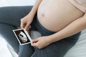 Eine schwangere Frau betrachtet ein Ultraschallfoto des Fötus. mutter berührt das baby sanft auf dem bauch. frauen sind 30 wochen schwanger. erste Liebe im Bauch und letzte Schwangerschaft foto