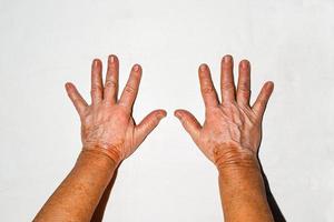 das Hände von Kinder und das Alten. ein jung Mädchen halten ihr Großvaters Hand im das Krankenhaus. foto