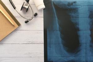Röntgenfotografie, digitales Tablet auf weißem Hintergrund foto