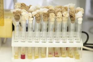 Prüfung Röhren mit Lösungen im das Labor von das ansteckend Krankheiten Krankenhaus. foto
