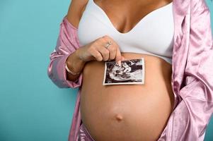 schwanger Mama zeigt an ein Ultraschall von ihr Sohn foto