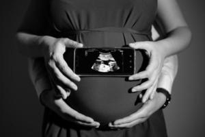 schwarz und Weiß Foto von das schwanger Frau halten das Ergebnisse von das Babys Ultraschall medizinisch Bildgebung, mit das Hände von das Mann halten das Bauch