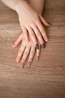 weiblich Hände Nahansicht mit nachgewachsen gebrochen Nägel. Mangel von Maniküre auf das Hände, gepflegt weiblich Hände foto