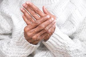 ältere Frau, die unter Handschmerzen Nahaufnahme leidet foto