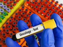 Blut Stichprobe zum Onkologie testen, Krebs. Prüfung Tube mit ein Blut Prüfung im das Arzt Hände. medizinisch Konzept. foto