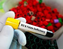 Blut Stichprobe zum b12 und Folsäure Mangel, Prüfung Tube mit Blut Arzt Hand. foto