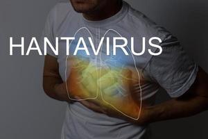 Text Hantavirus. Notfall Konzept. Hanta Virus, PS Virus Infektion Lungen Syndrom PS. Ausbruch geht weiter zu Verbreitung draußen China. foto