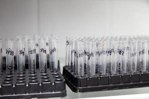 Gruppe von Prüfung Röhren enthält geduldig Proben bereit zum fließen Zytometrie Analyse. foto