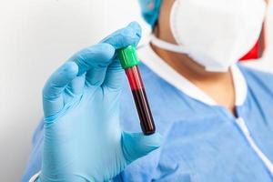 Nahansicht von ein Prüfung Tube mit Blut Stichprobe gewesen halt durch ein weiblich im ein klinisch Labor foto
