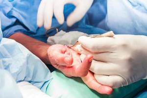 der Chirurg nähen das Hand von ein geduldig beim das Ende von Chirurgie foto