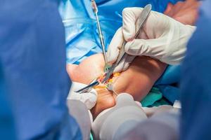 Gruppe von orthopädisch Chirurgen durchführen Chirurgie auf ein geduldig Arm foto