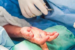 der Chirurg nähen das Hand von ein geduldig beim das Ende von Chirurgie foto