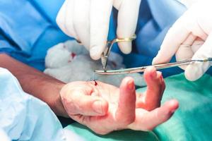 der Chirurg nähen das Hand von ein geduldig beim das Ende von Chirurgie foto