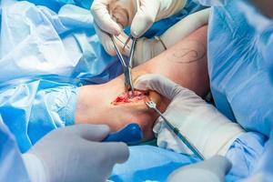 Gruppe von orthopädisch Chirurgen durchführen Chirurgie auf ein geduldig Arm foto