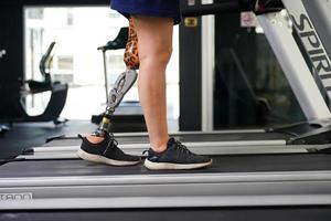 jung weiblich mit einer Prothese Bein mit Übung durch Gehen auf ein Laufband zu trainieren Gehen mit das andere Prothese Bein zu Sein Mehr flexibel. foto