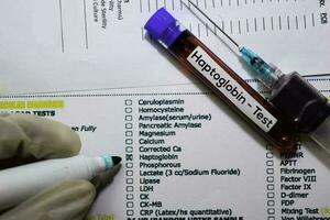 Haptoglobin - - Prüfung mit Blut Probe. oben Aussicht isoliert auf Büro Schreibtisch. Gesundheitswesen medizinisch Konzept foto