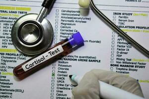 Cortisol - - Prüfung mit Blut Probe. oben Aussicht isoliert auf Büro Schreibtisch. Gesundheitswesen medizinisch Konzept foto
