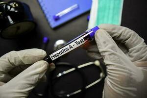 Hepatitis ein - - Prüfung mit Blut Probe. oben Aussicht isoliert auf schwarz Hintergrund. Gesundheitswesen medizinisch Konzept foto